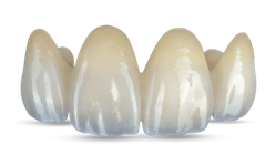 Same-Day Dental Crown