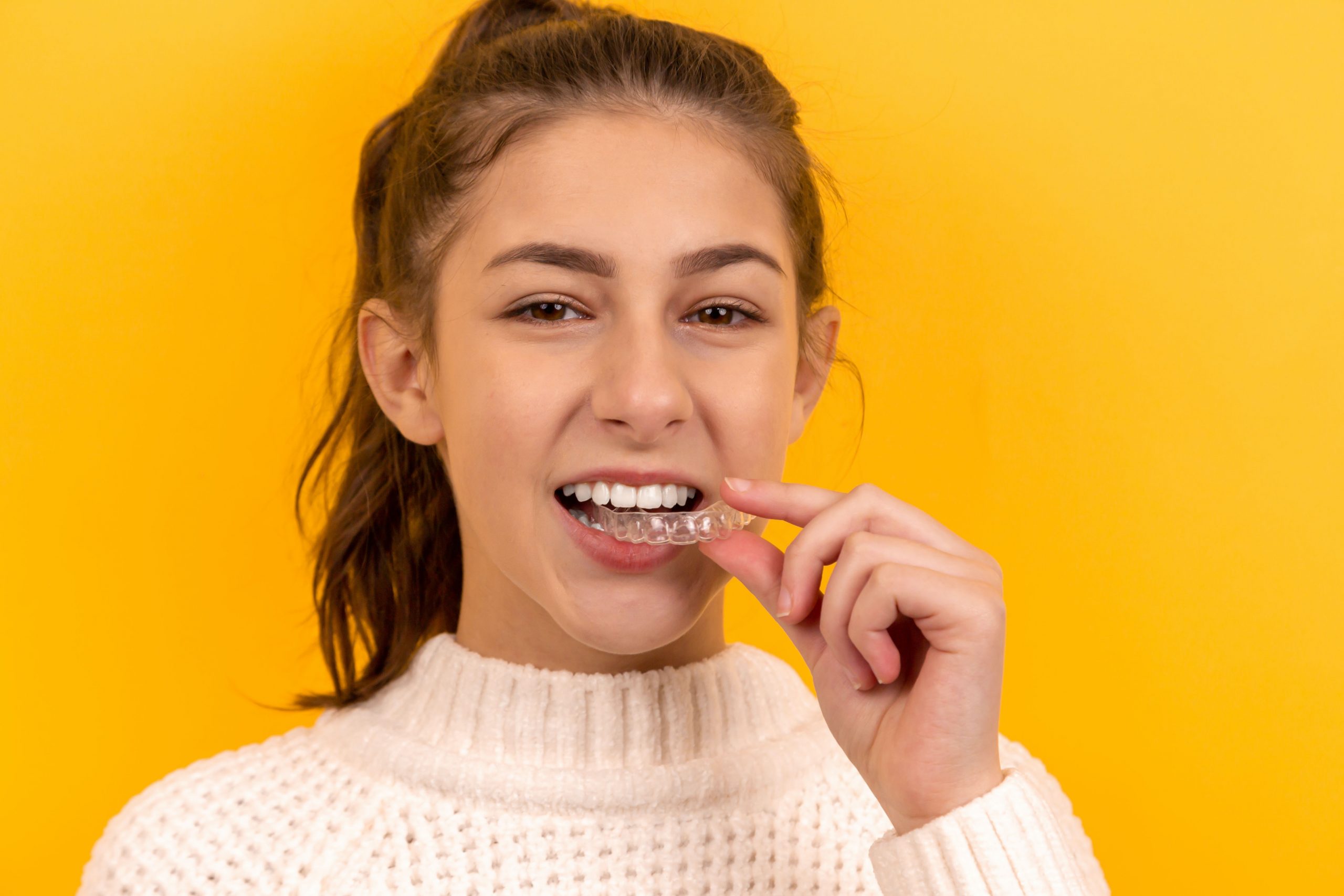 Clear Aligners For Teeth