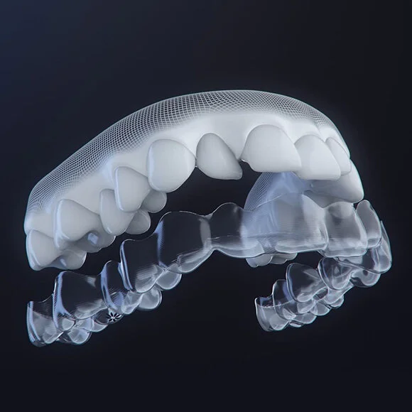 Invisalign high-tech process