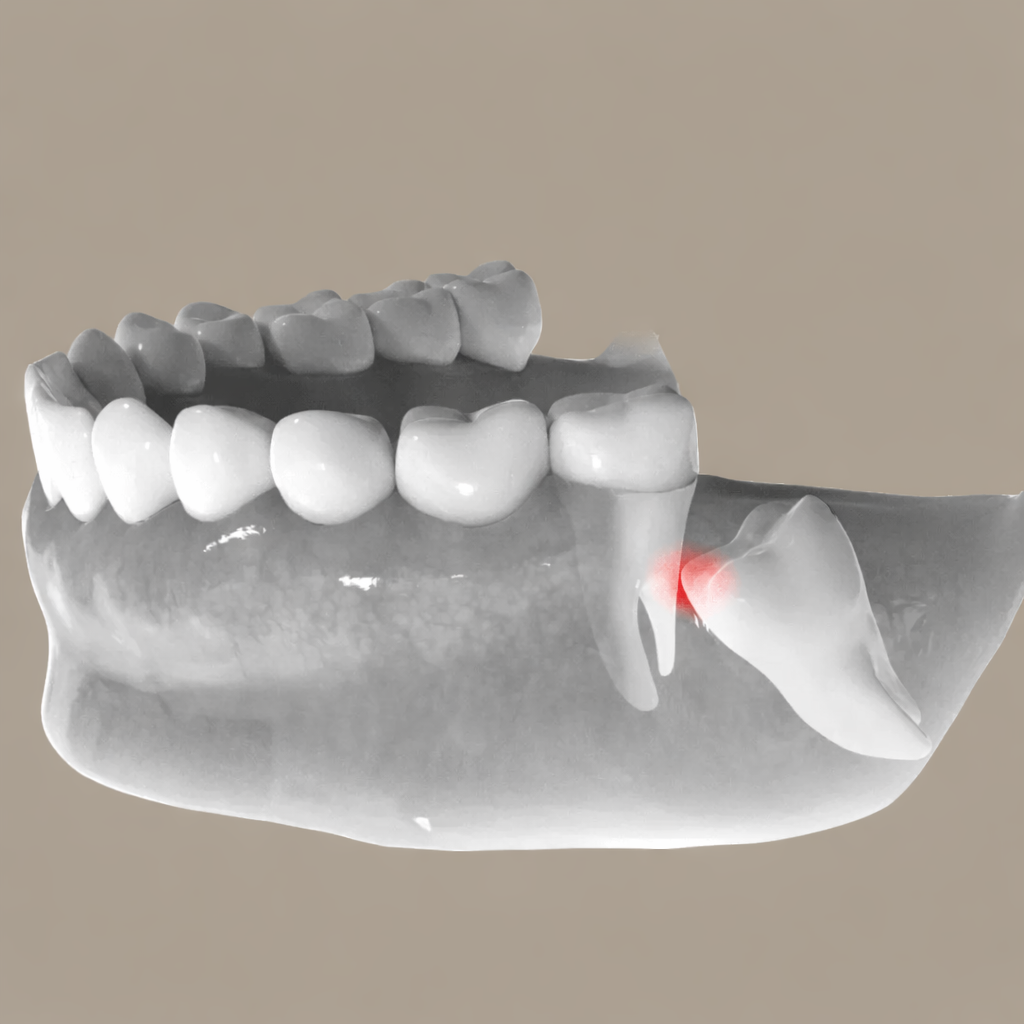 Wisdom teeth 3D illustration