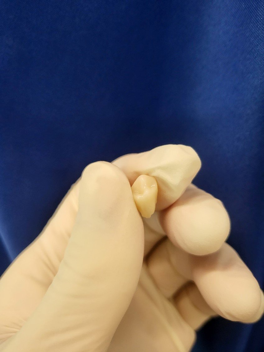Putty Impression