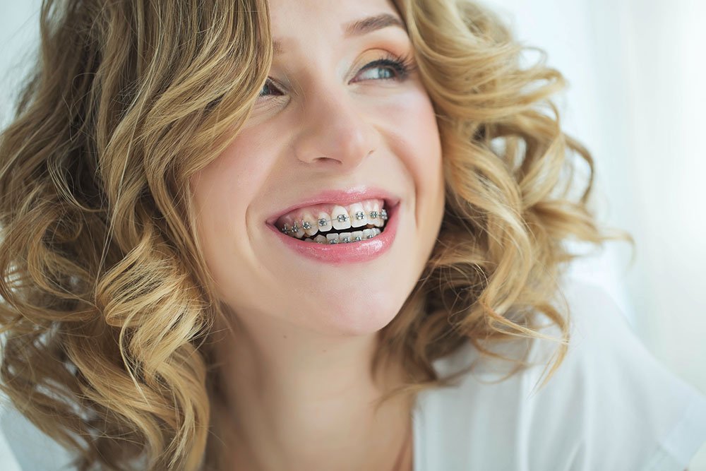 Benefits of Orthodontics