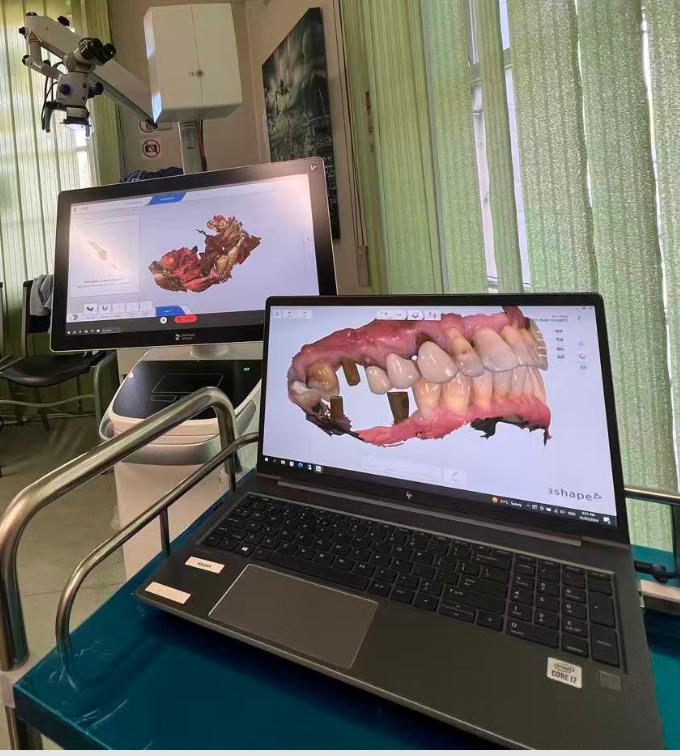 Dental implant consultation