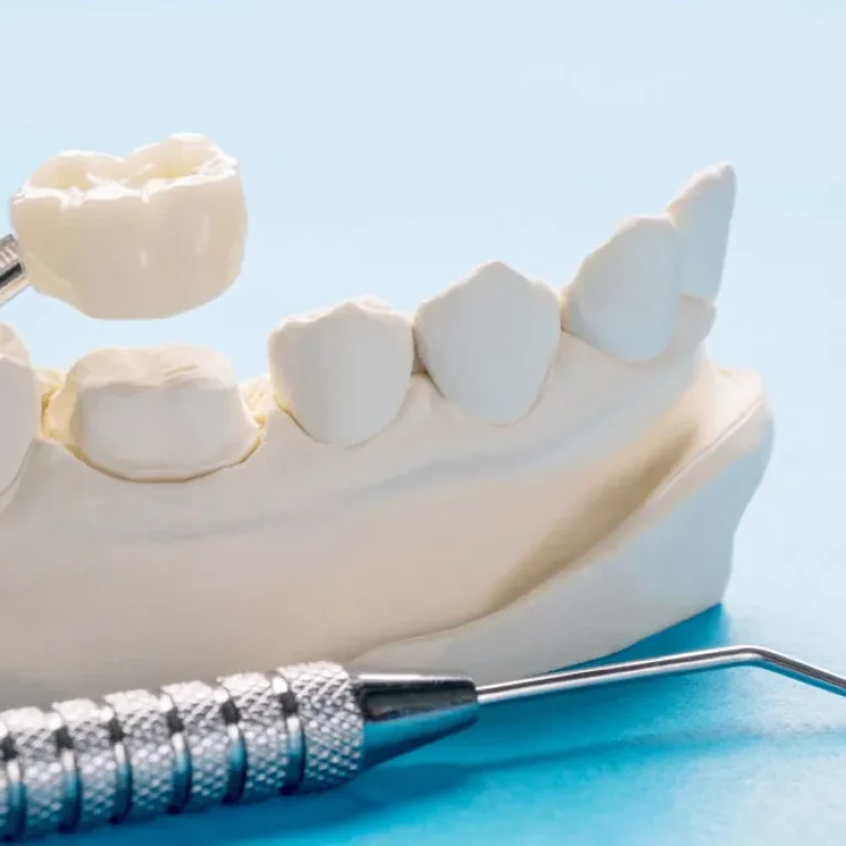 dental-crowns
