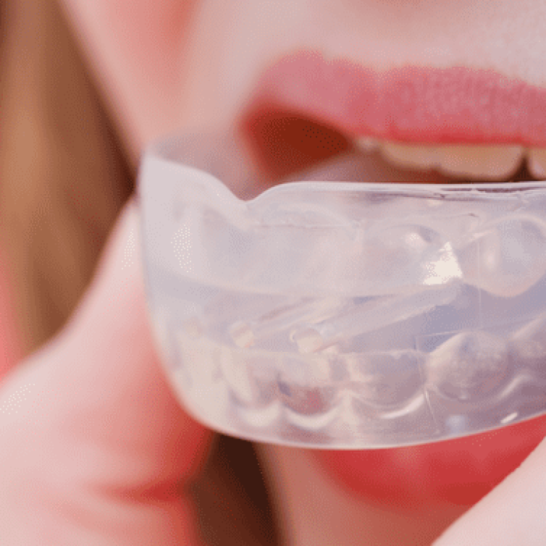 mouth guard
