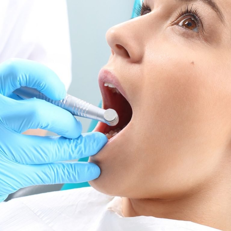 root canal