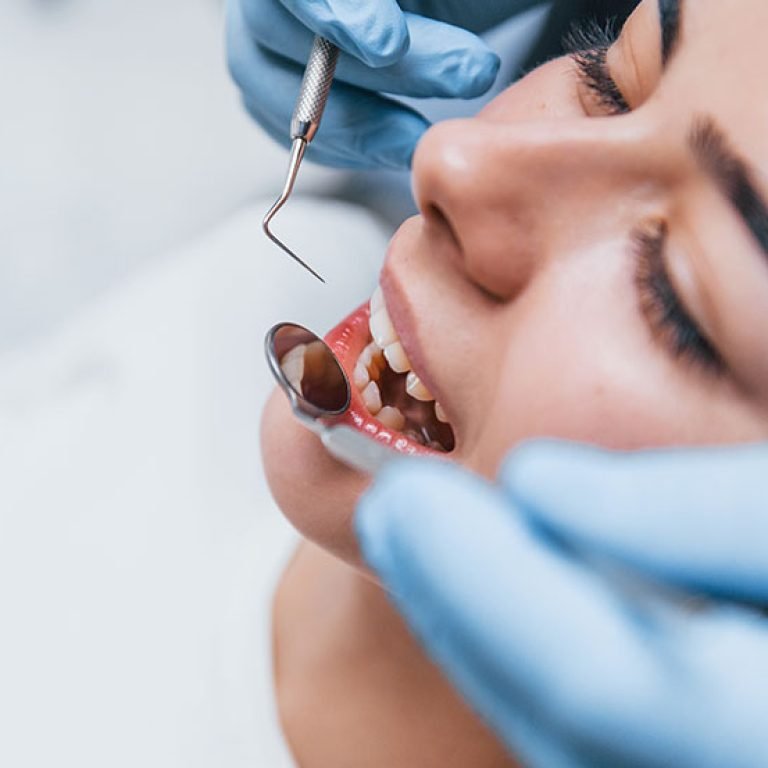 same-day-dental-crowns-image1